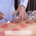 Acupressure Fire Cups glass cups hijjama set of 16pc - Image 2