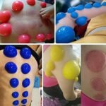 Silicone Vacuum Cupping Set, 12 Pieces, Half Ball Cupping Therapy Cans, Rubber Body Slimming Suction Cups Set Of 12 - Image 2